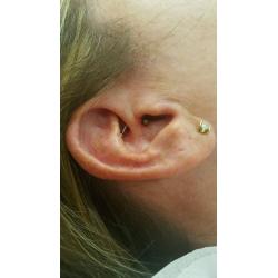 Body piercing