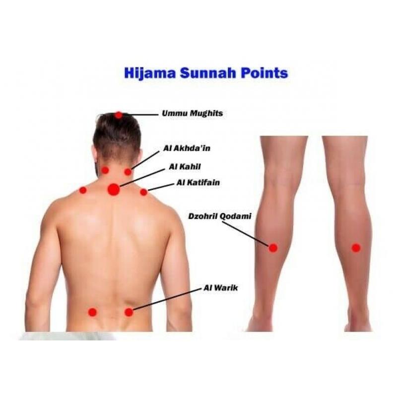 south norwood 1 day hijama cupping beauty clinic diploma course insurance certificate mobile therapy